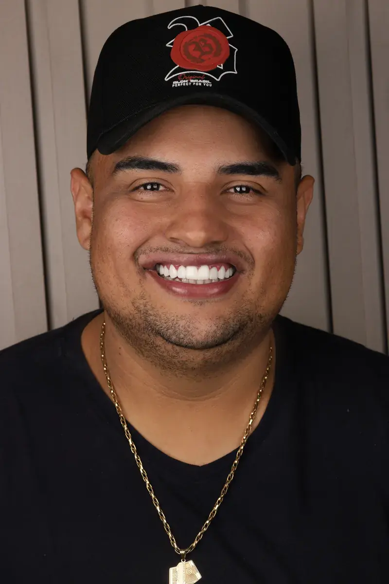 Sorriso com lentes de contato dental